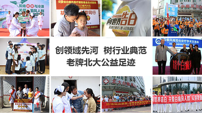 合肥北大白癜风公益